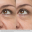 Daily Hydro-Drops Eye Gel Cream - Obagi