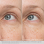 Daily Hydro-Drops Eye Gel Cream - Obagi