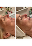 Intraceuticals