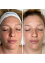 Intraceuticals