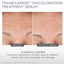 TranEXamide Discoloration Serum - Glytone